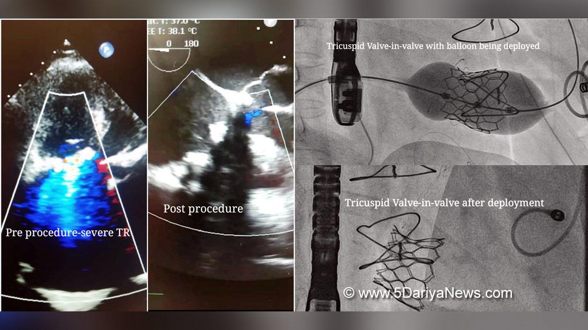 Health, Bangalore, Aster RV Hospital, Karnataka, Dr. S. Venkatesh