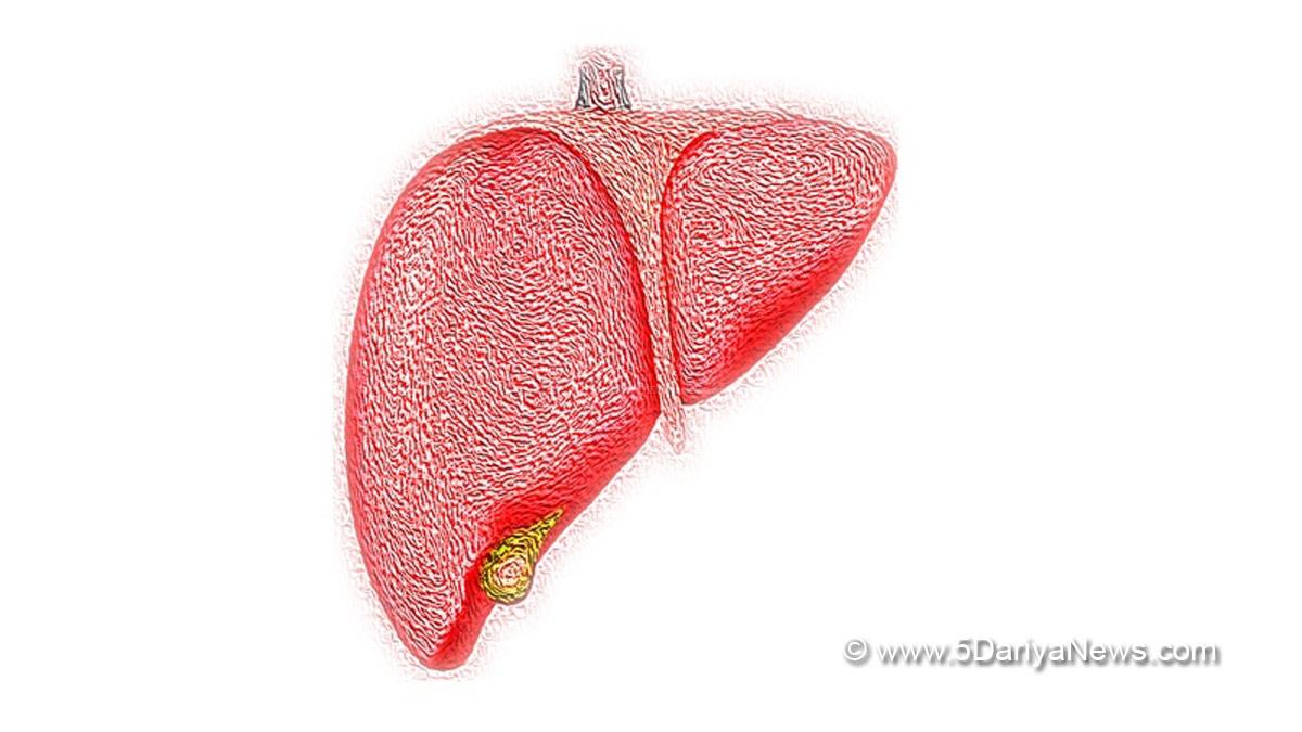 Health, Study, New Delhi, Research, Researchers, World Liver Day, Liver Disease