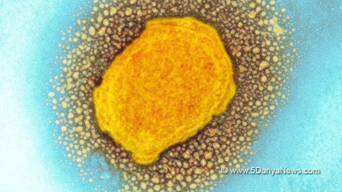 Monkeypox Virus, Monkeypox, Health, Study, Research, Researches, Symptoms Monkeypox Virus, MonkeyPox Disease, Monkeypox Symptoms, MonkeyPox Cures
