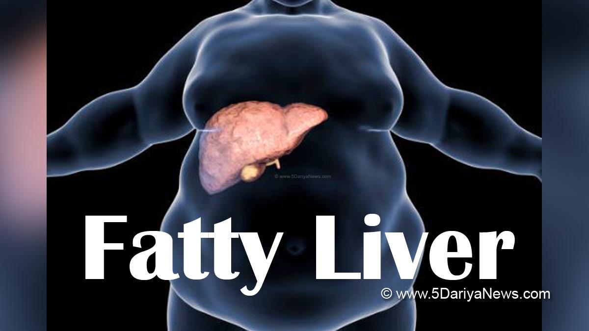 Health, Study, Research, Fatty Liver, Fat, Liver Fat, Liver, Fatty Liver causes, Fatty Liver symptoms,  Methods Of Preventing Fatty Liver