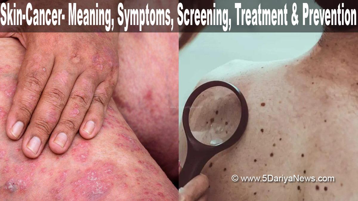 Skin care, Skin Cancer, Cancer, Skin Cancer Meaning, Skin Cancer Symptoms,  Skin Cancer Screening, Skin Cancer Treatment, Skin Cancer Prevention, Health, Study, Research