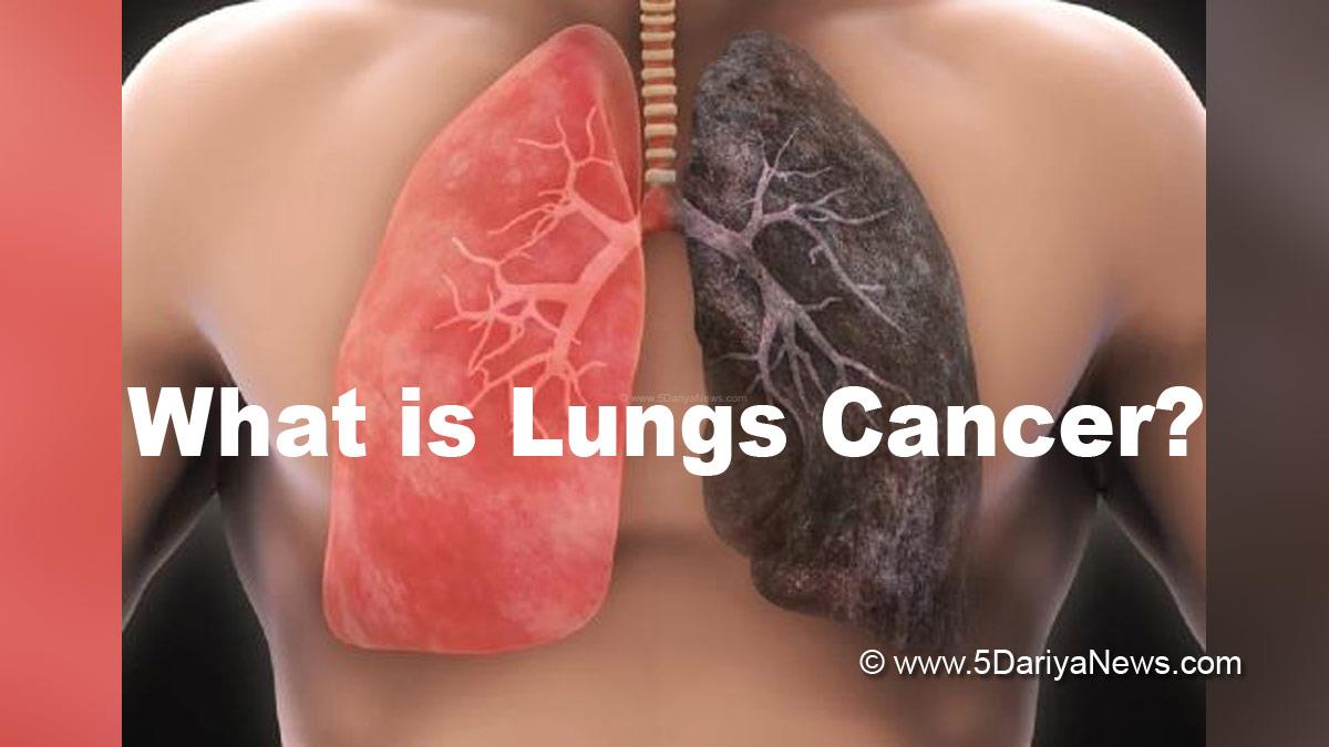 Health , Study , Research , Cancer , Lung Cancer , Lung Cancer Symptoms , Lung Cancer Treatment , Lung Cancer Causes , Lung Cancer Types , Lung Cancer Diagnosis