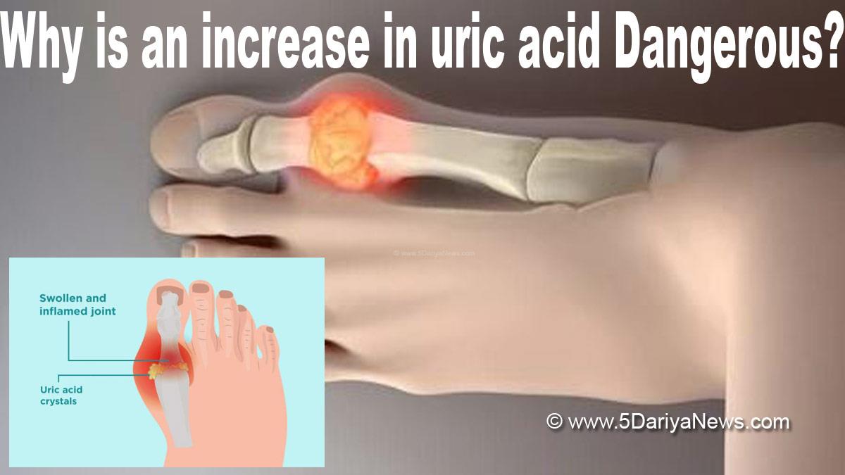  Health , Study , Research , Uric Acid , Uric Acid Diet , Uric Acid Symptoms , Uric Acid Treatment , Uric Acid Medicine , Uric Acid Levels , Uric Acid Symptoms In Hindi
