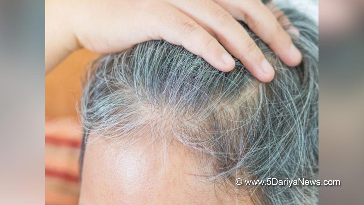 What Causes White Hair at Early Age And How To Prevent It | Be Beautiful  India