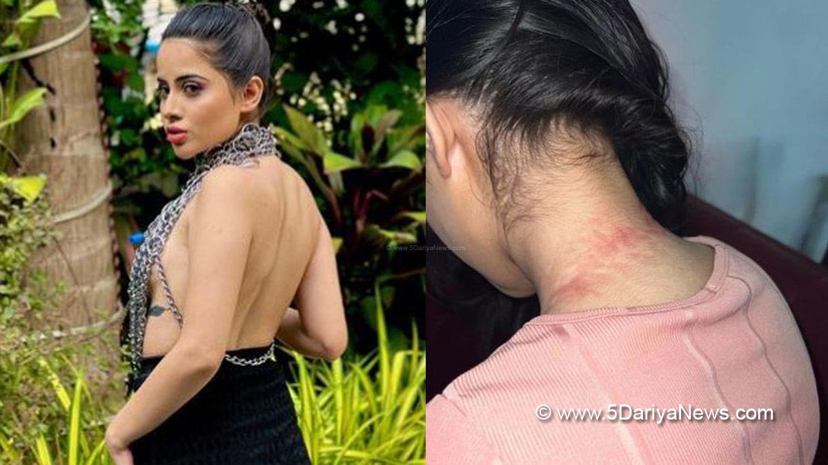 Uorfi Javed, Uorfi Javed Latest News, Uorfi Javed Injury, Uorfi Javed Neck Injury, Uorfi Javed Chain Dress, Uorfi Javed Instagram