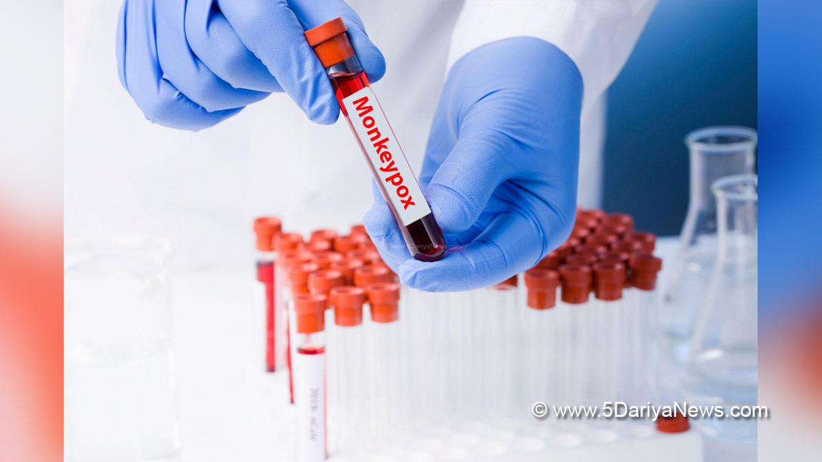 Health, Monkeypox Virus, Monkeypox, Health, Study, Research, Researches, Symptoms Monkeypox Virus, MonkeyPox Disease, Monkeypox Symptoms, MonkeyPox Cures