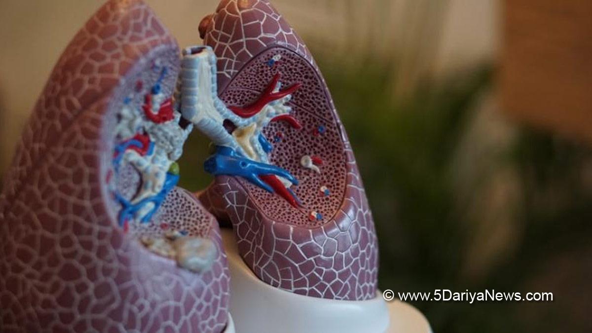 Health, Study, Bengaluru, Research, Researchers, World Health Organisation, WHO, World Lung Cancer Day, World Lung Cancer Day 2022, World Lung Cancer Day Theme, World Lung Cancer Day 2022 Theme