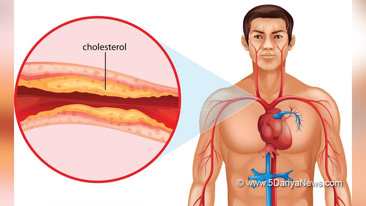 Health, Study, Research, Cholesterol Symptoms, Cholesterol Meaning, Cholesterol Cause, Cholesterol Cures, Cholesterol Diet, Cholesterol Test, Cholesterol, Cholesterol Consequences, Cholesterol, Home Remedies