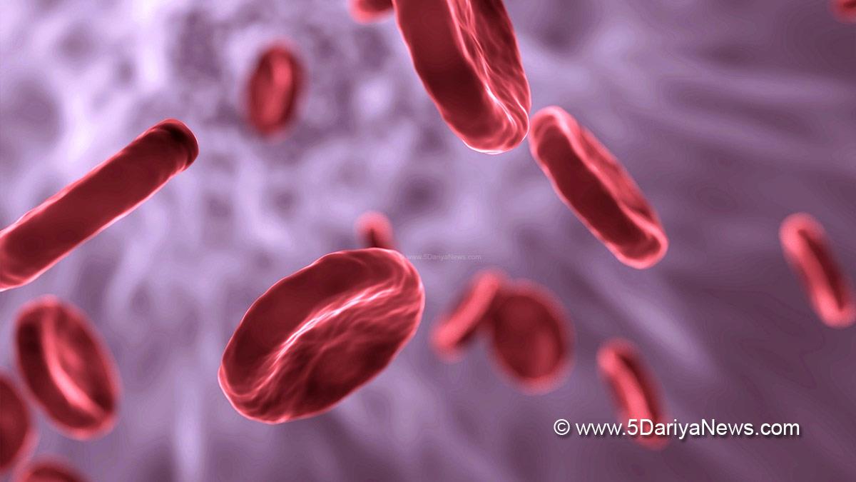 Health, Study, Research, Researchers, Screening, Stem Cell Therapy, World Sickle Cell Day 2023, Red Blood Cells, Dr Rajkumar, Sr Consultant Internal Medicine, Indian Spinal Injuries Centre, Dr. Santanu Sen, Pediatric Hematology, Oncology, Stem Cell Transplantation