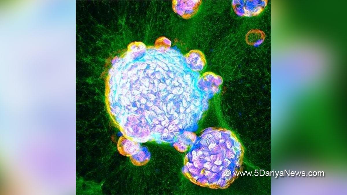 Health, Study, New York, Research, Researchers, World News,  Stem Cell Therapy, Neurona Therapeutics, NRTX-1001, Oregon Health & Science University
