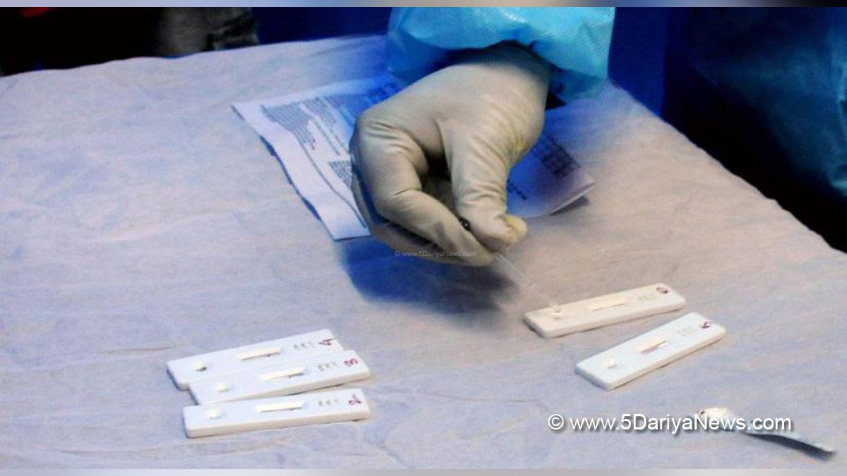 Health, Study, New York, Research, Researchers, World News, HIV, HIV Rapid Test, HIV TB, HIV TB Rapid Test, TB, TB Rapid Test, Tuberculosis, Tuberculosis Rapid Test, Tuberculosis Testing, HIV Testing