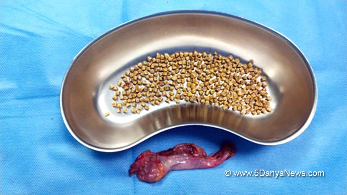 Health, Aster RV Hospitals, Aster RV Hospital Bangalore, Dr. Shivaprasad Giliyar Srinivasa