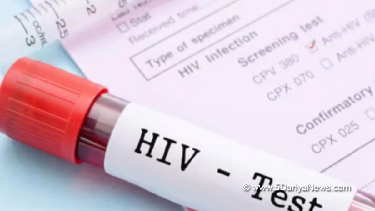Health, Study, New York, Research, Researchers, World News, HIV, HIV Symptoms, Hiv symptoms In Men, Hiv symptoms In Women, Hiv Testing, Hiv Aids, Hiv Treatment, Aids