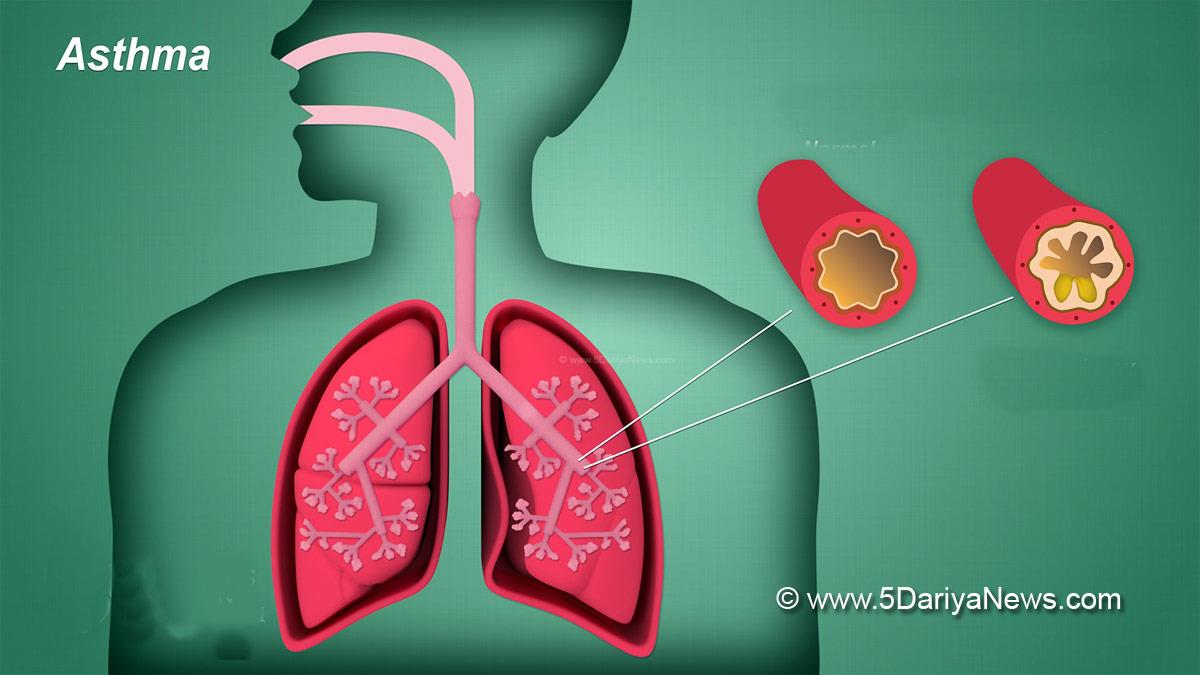 Health, Study, New York, Research, Researchers, World News